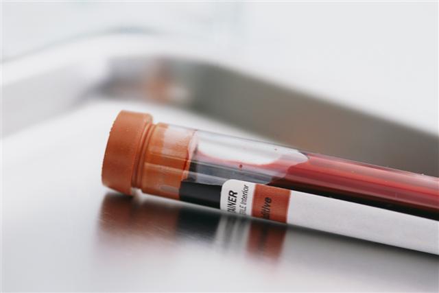 blood draw