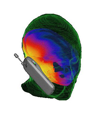 radiation-effects-on-brain