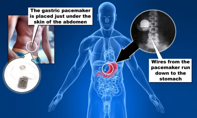 highlighted stomach. Image shot 2008. Exact date unknown.