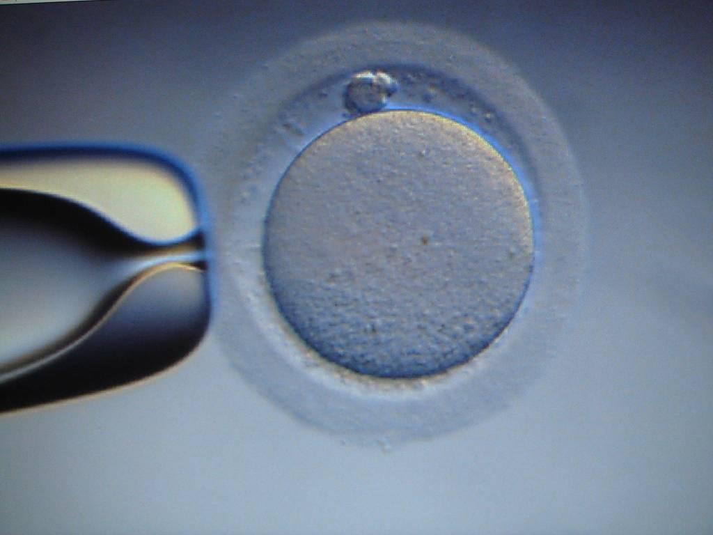 Resultado de imagen de ovulos congelados