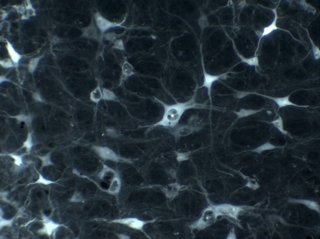 neuron