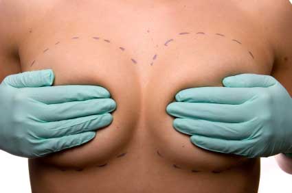 Best-Size-For-Breast-Implants