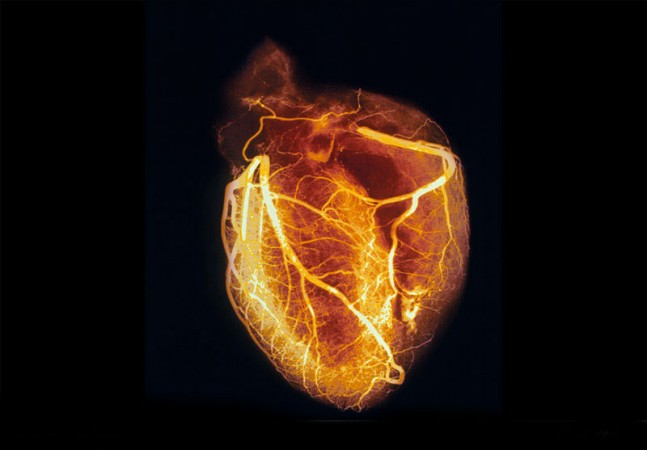 corazoneditada