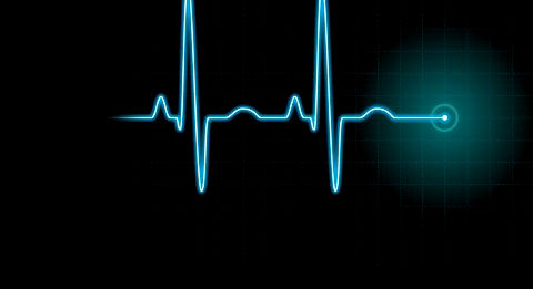 electrocardiograma foto