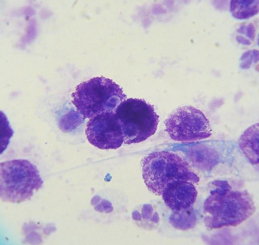 Mast_cell_tumor_cytology_2 []