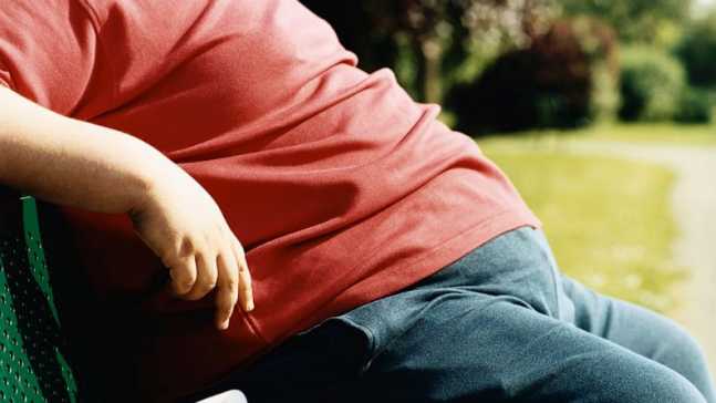 Obesity