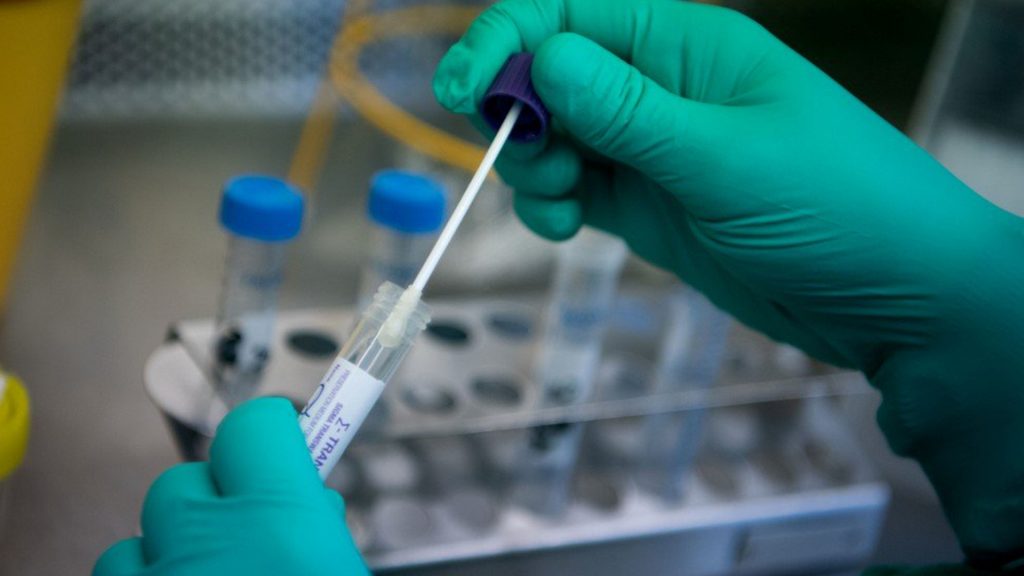 prueba pcr
