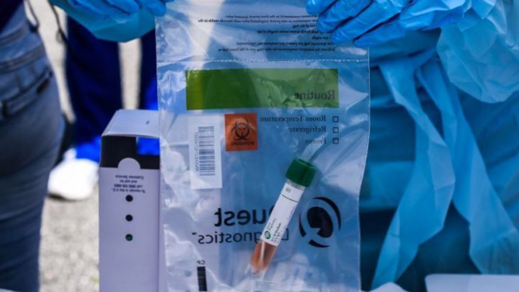 #ReporteCoronavirus | Las 7 noticias más importantes hasta la mañana del #25Ago