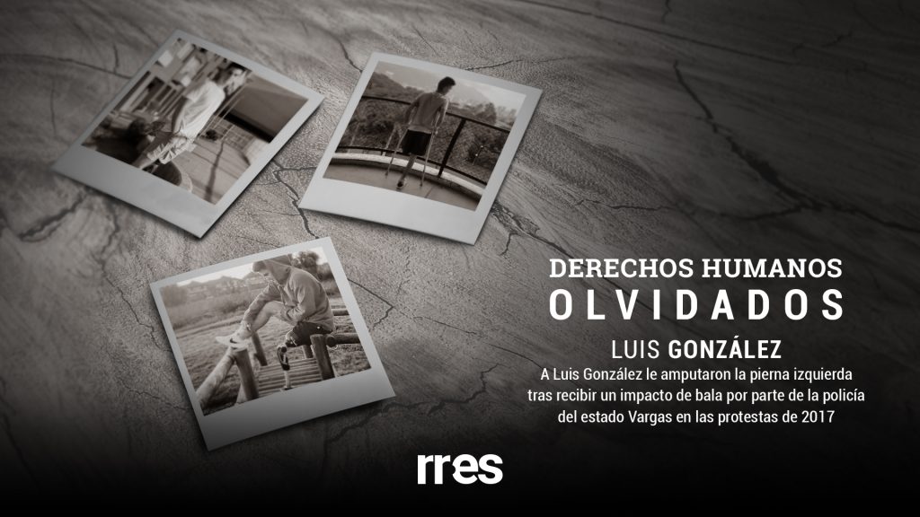DDHH olvidados | El día en que Luis González despertó sin una pierna