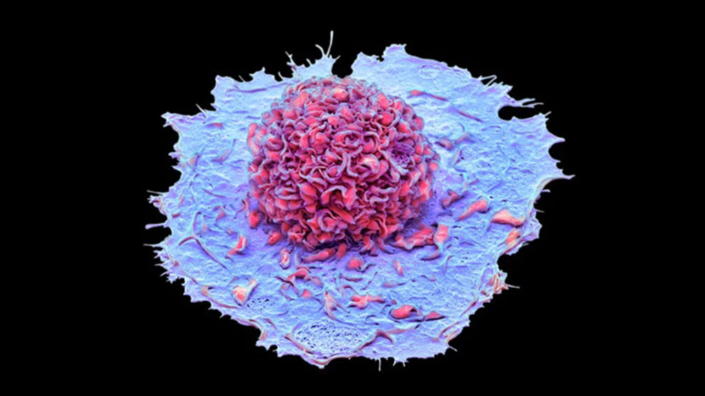 #reportecoronavirus