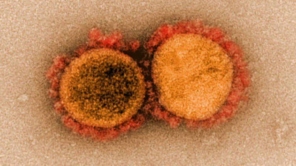 #reportecoronavirus