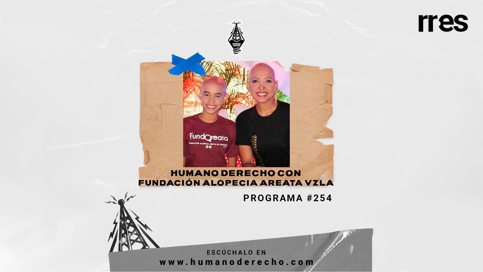Humano Derecho #254 con Yukency Sapucki, de la fundación Alopecia Areata Venezuela