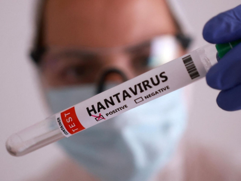 Ministerio de Salud confirma tres muertes en Anzoátegui por hantavirus